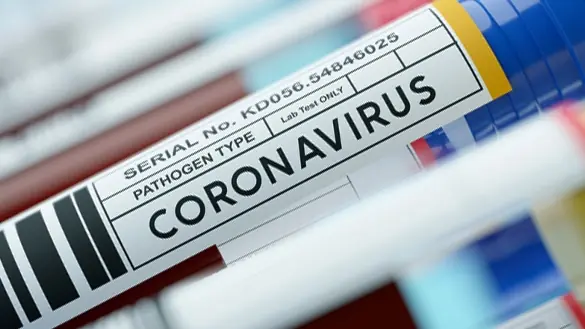 Au cours des dernières 24 heures, 115 admissions de Covid-19 à l'hôpital et 135 patients ont été libérés.